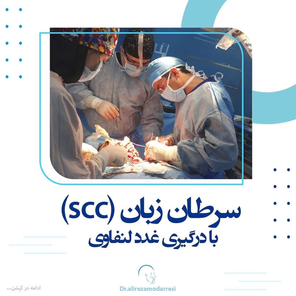 جراحی سرطان زبان (SCC) با درگیری غدد لنفاوی