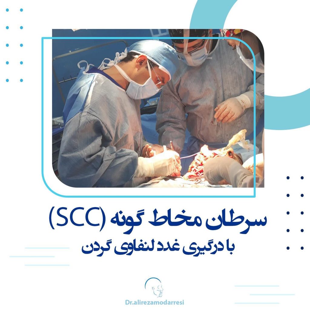 جراحی سرطان مخاط گونه (SCC) با درگیری غدد لنفاوی