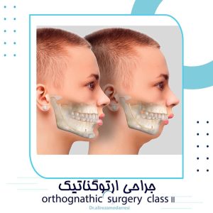 جراحی ارتوگناتیک (جراحی فک)