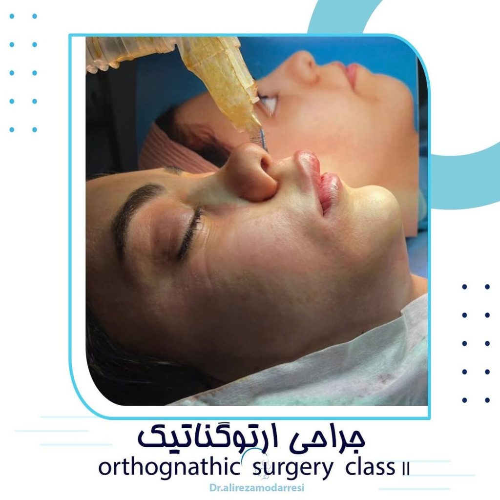 جراحی ارتوگناتیک (جراحی فک)